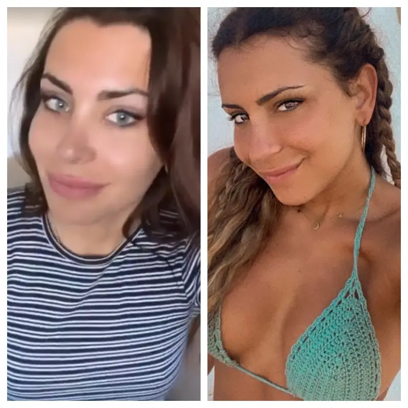 Daniela Requena antes y después del cambio de color de ojosFuente externa 