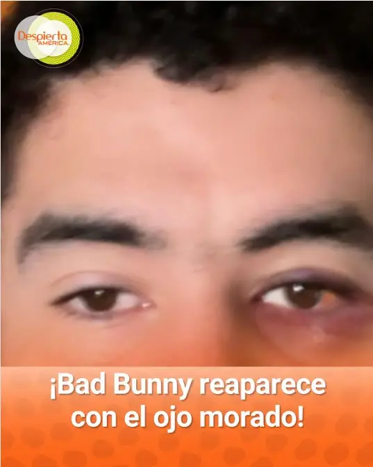  Bad Bunny por imagen con ojo morado