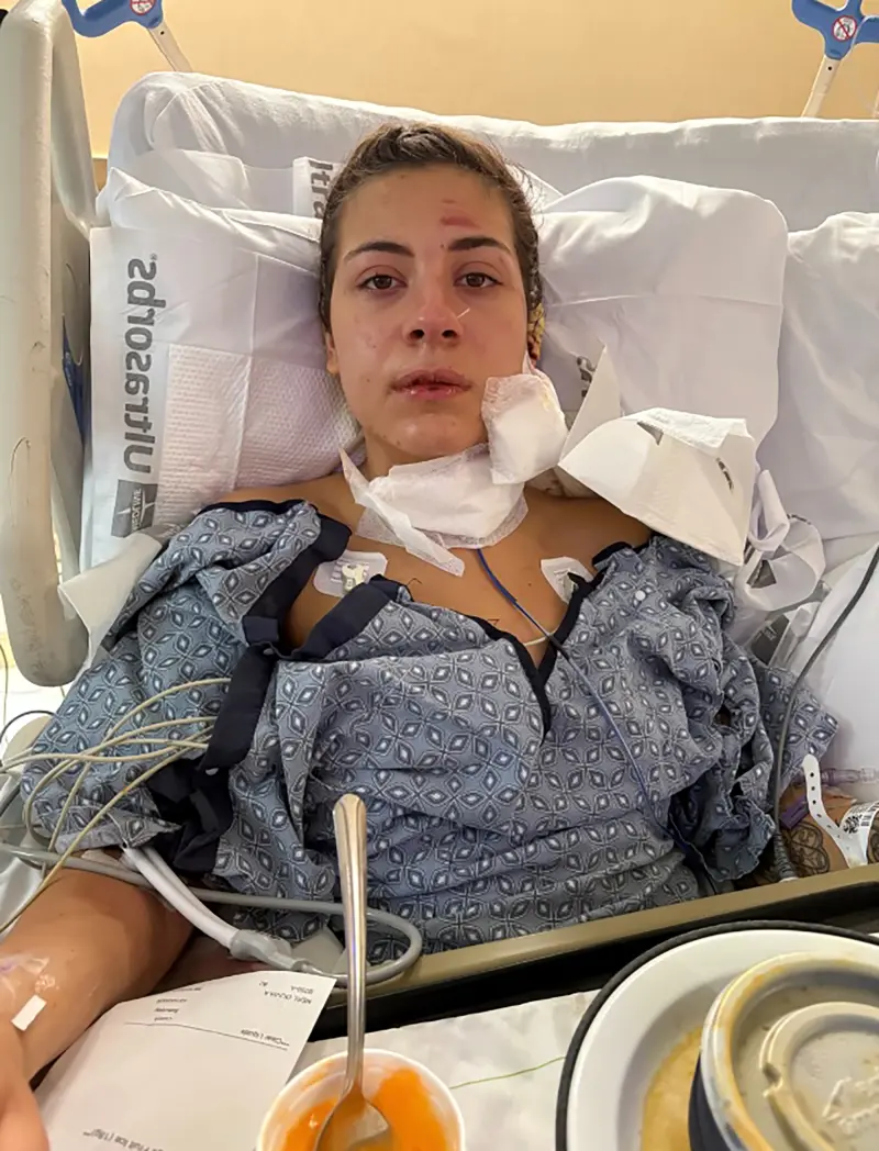 Olivia Neri, una estudiante universitaria de Nueva York, fue hospitalizada tras ser afectada por un compañero de trabajo mientras lo llevaba a casa en coche el 9 de octubre de 2026.GoFundMe.com